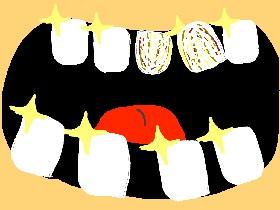 Dentist Rage!!!!! 1