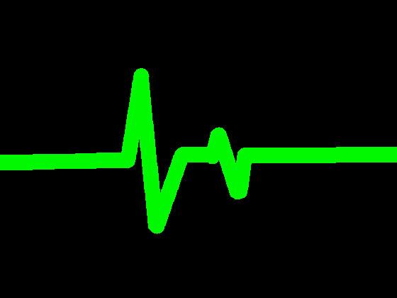 Heartbeat