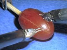 they did surgery on a grape dont believe look it up