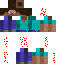Chicken Pox Steve Skin 13